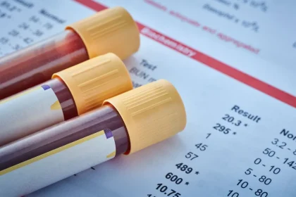 Blood Type Distribution